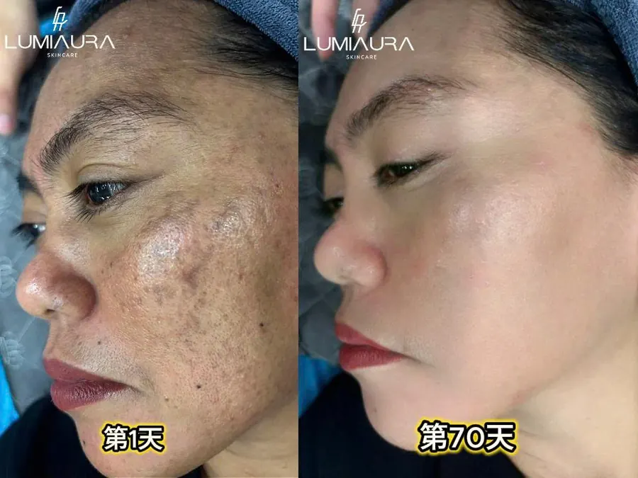 顧客使用前後對照