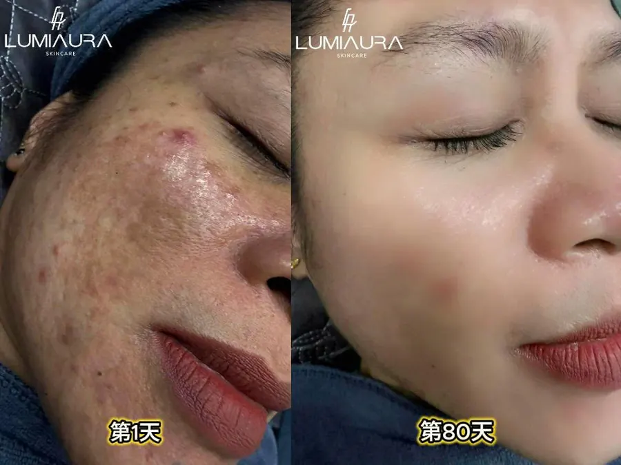 顧客使用前後對照