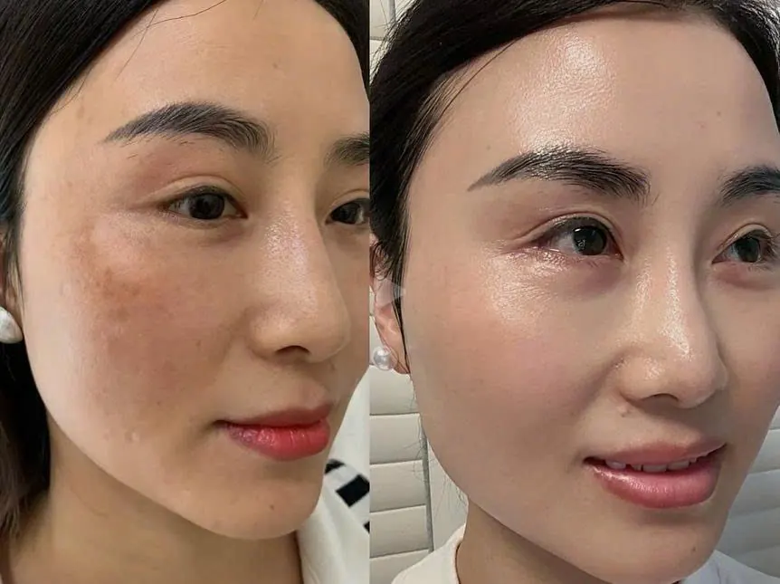 顧客使用前後對照