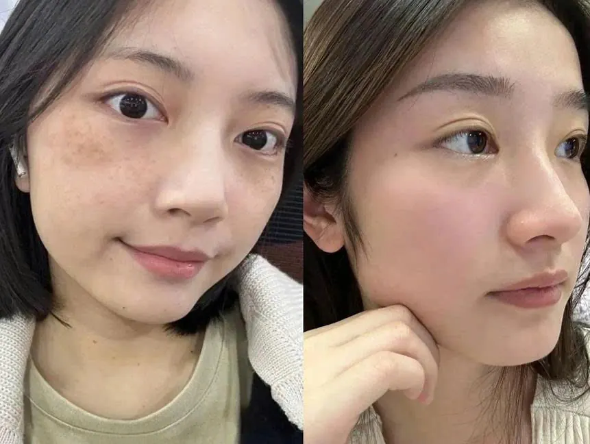 顧客使用前後對照